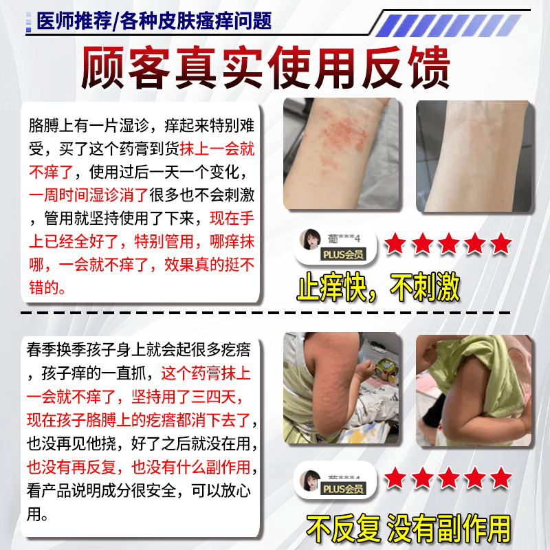狼毒蛇床子祛痒膏止痒膏抑菌皮肤瘙痒皮湿炎疹真菌感染止痒药膏 特效买2送1【一抹止痒】