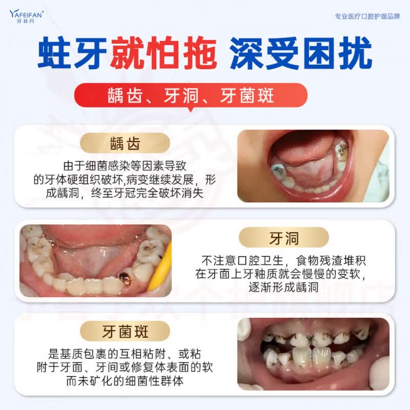 鹿角卉牙非凡防蛀牙膏龋齿美白清新祛黄去渍去口臭清新口气牙护龈固齿 三支装【蓝色山茶花款】 官方自售