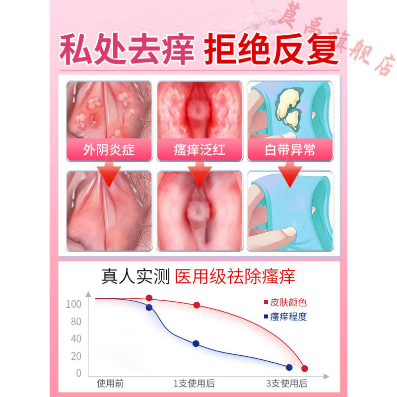 熏姿颜洁康i宁妇科喷i剂外阴瘙痒止痒抑菌消炎妇科止痒阴道炎私处洗护尿 5瓶【严重反复瘙痒】买3送2 官方直售