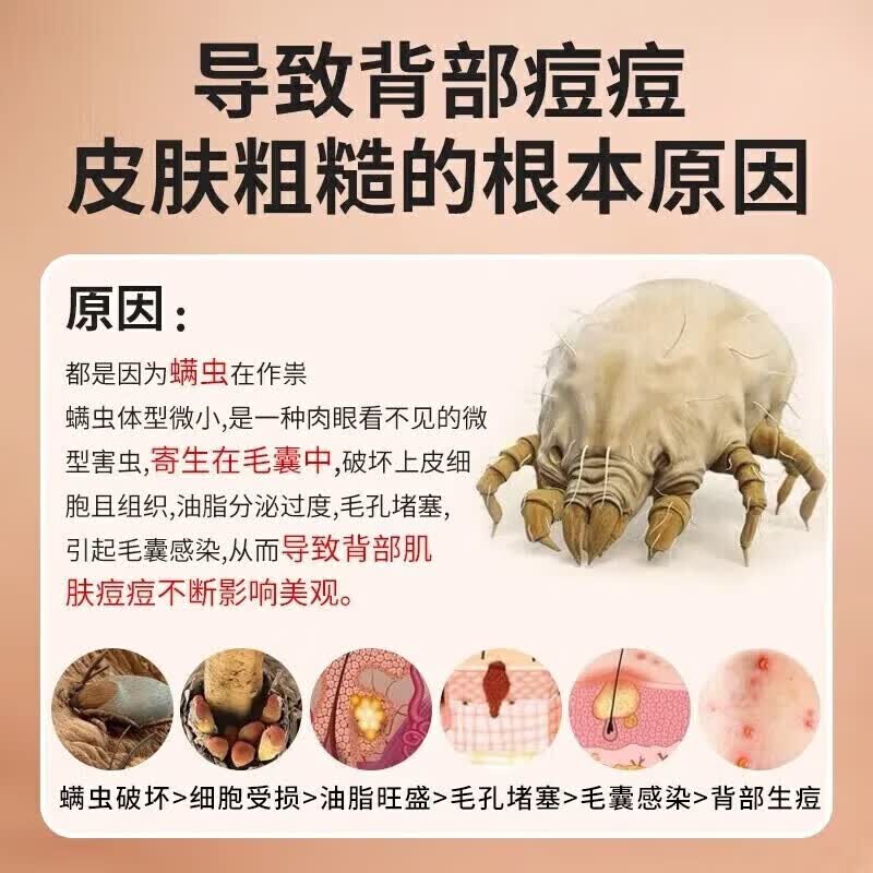 国药精养硫磺皂除螨沐浴露控油止痒杀菌螨虫痘男女洗脸洗头洗澡三合一 一瓶装400ml