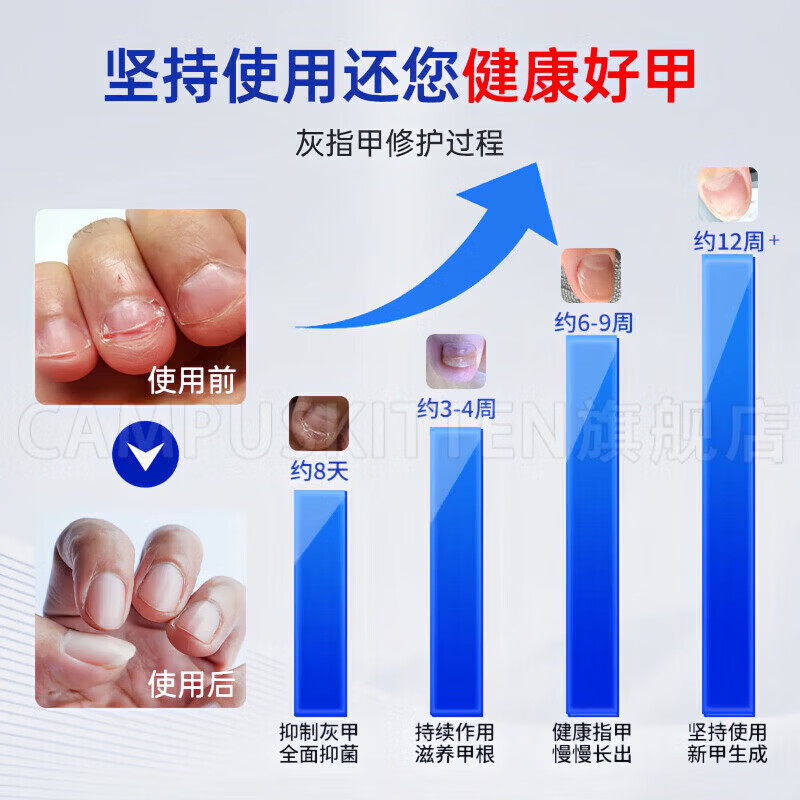 BEIYVS甲贝诺灰甲灰甲保健擦剂专用浑浊坏甲厚变黄真菌感染脱甲官方 1盒【体验见效装】 【官方直售】