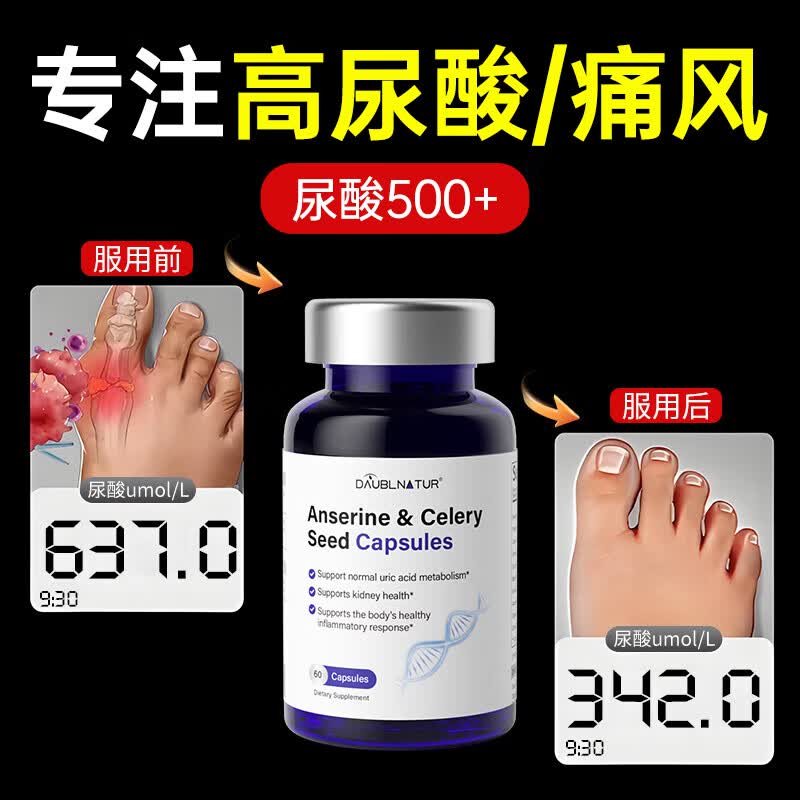 DAUBLNATUR美国鹅肌肽西芹菜籽痛风石关节炎红肿痛药降消高尿酸丸胶囊赖氨