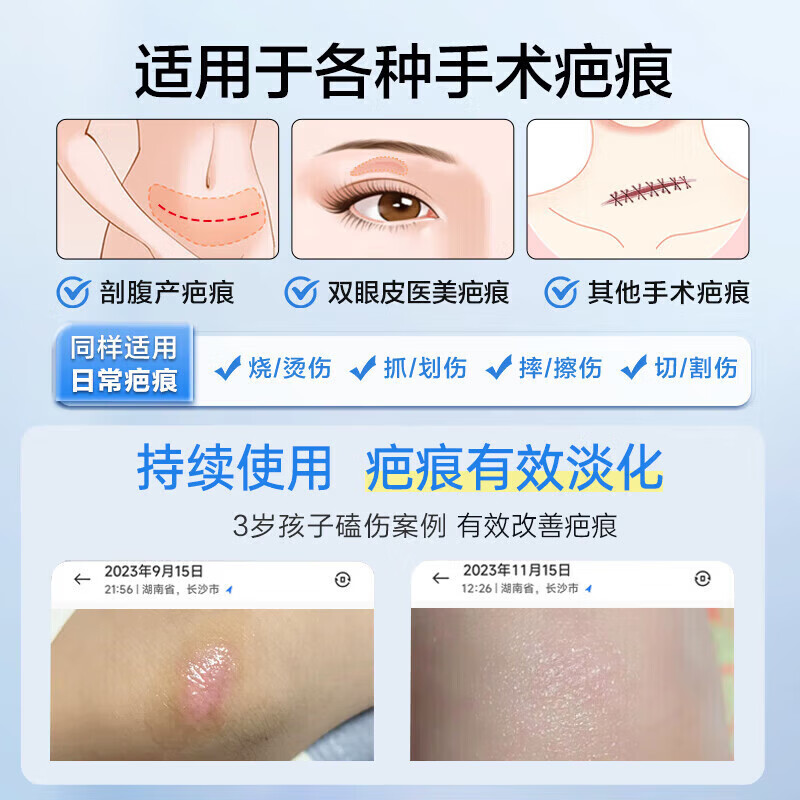 可孚医用硅酮疤痕凝胶20g手术增生剖腹产烧烫伤淡疤大容量C1型 【高粘复合疤痕改善】1支