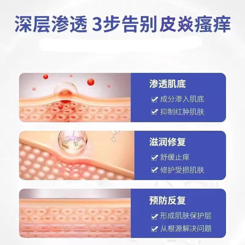 皮炎宁酊水正品老牌子正牌外用皮肤膏内蒙古大唐止痒抑菌液痒灵丁 买3送2【5盒】巩固装