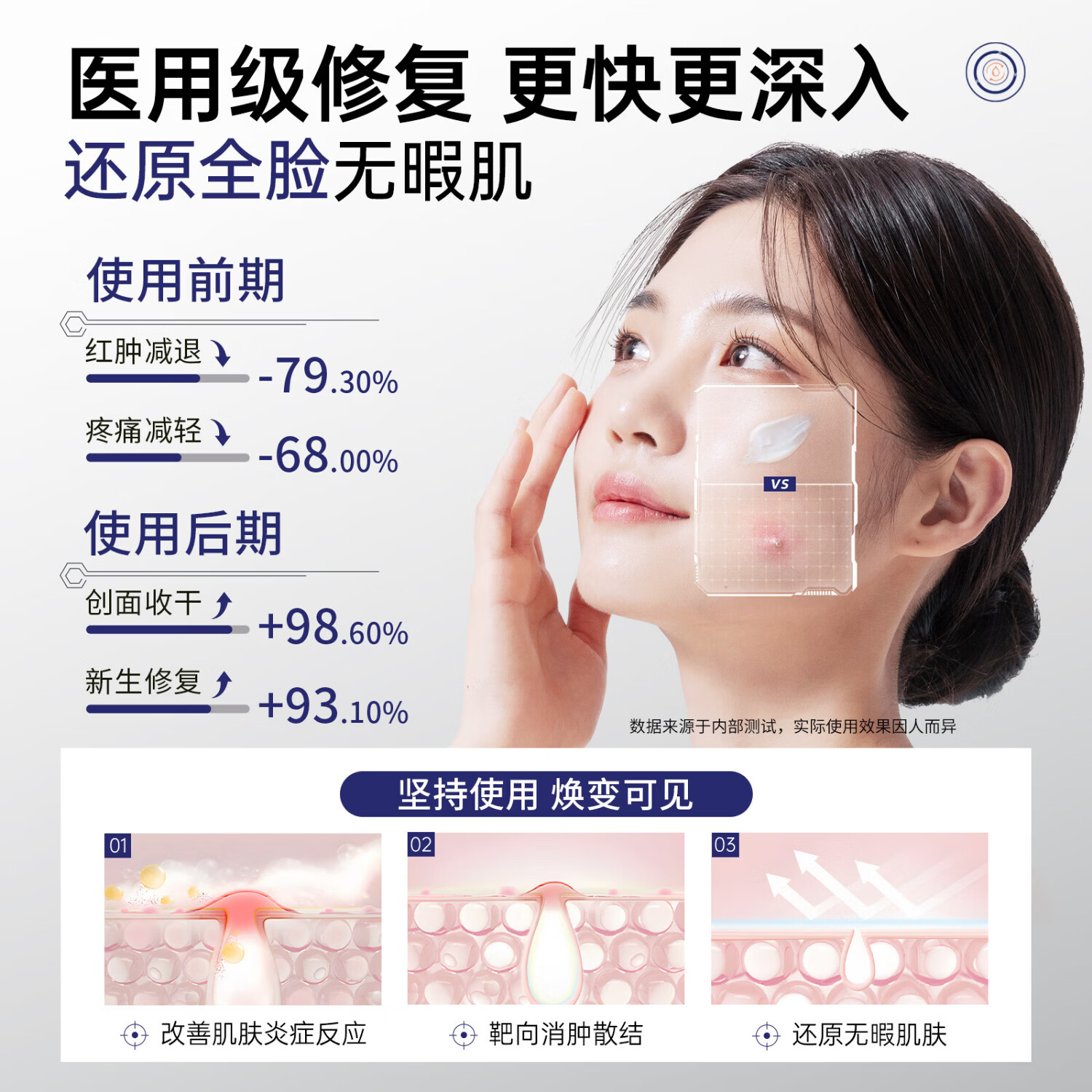 宽博士祛痘凝胶医用透明质酸钠修复软膏去火疖子改善痘痘 三盒【巩固装】