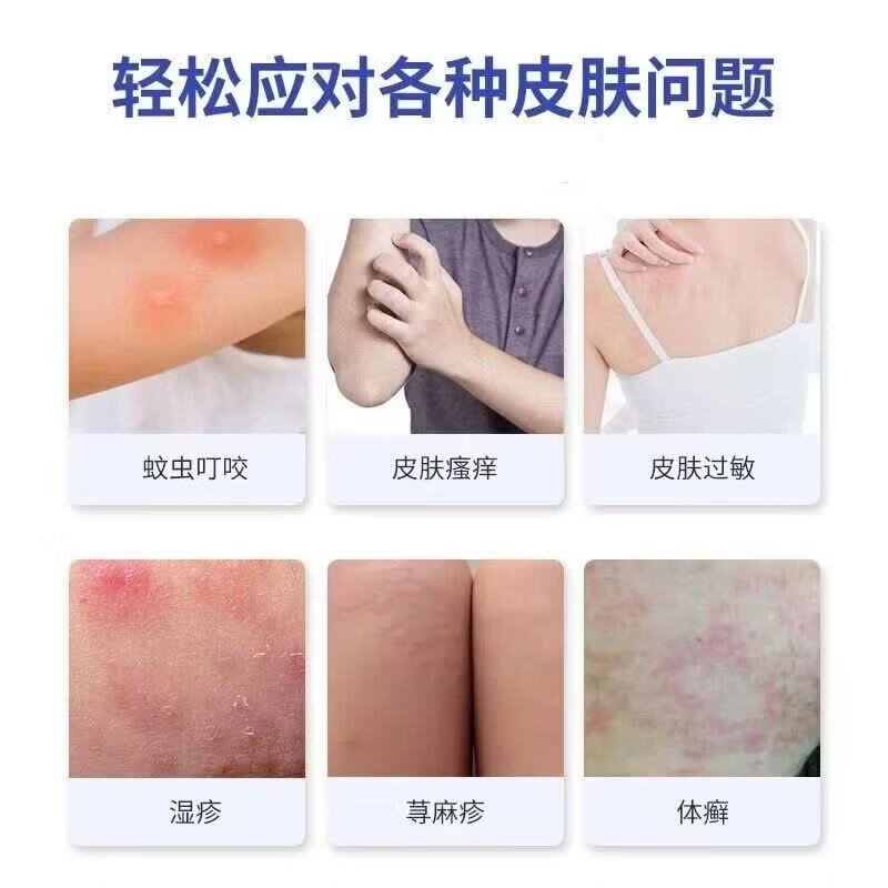 皮炎宁酊水正品老牌子正牌外用皮肤膏内蒙古大唐止痒抑菌液痒灵丁 买3送2【5盒】巩固装