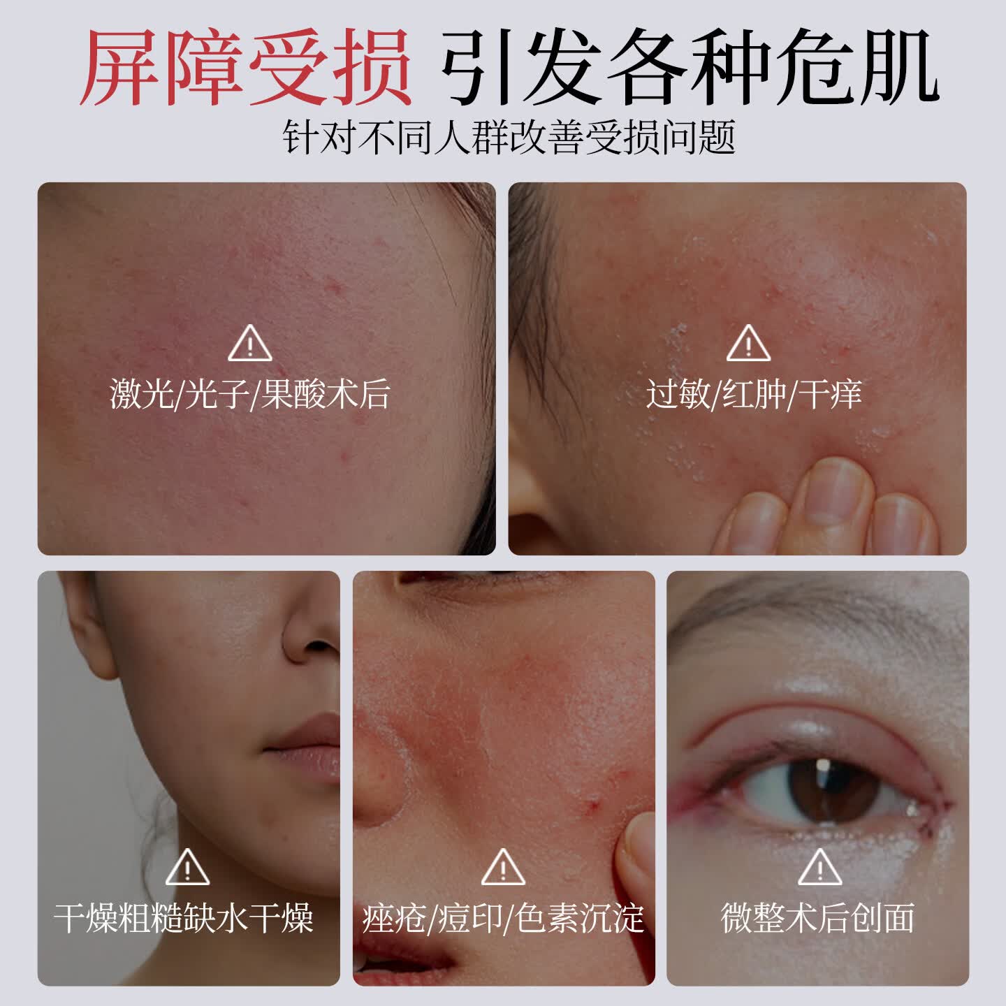 梵月如茵重组胶原蛋白术后修复淡纹紧致痤疮肌敏感肌肤创面敷贴 医用重组胶原蛋白皮肤创面敷贴5盒/25贴