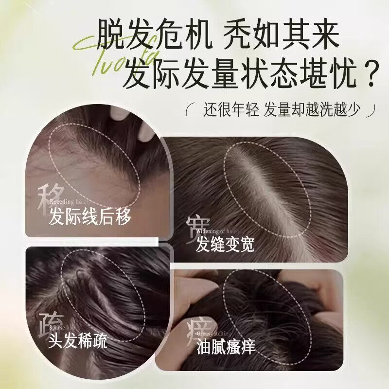 NETST木诺康侧柏叶洗发水草本防脱固发育发密发增发防断发去屑控油止痒 一瓶装【体验装】 【官方旗舰正品 京质保障】