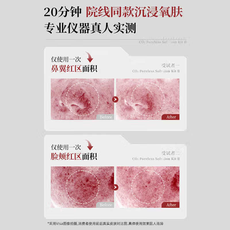 szco丹宜诗韩国碳酸面膜白瓷娃娃注氧面膜2.0补水提亮七夕情人节礼物 【3盒装】碳酸注氧面膜