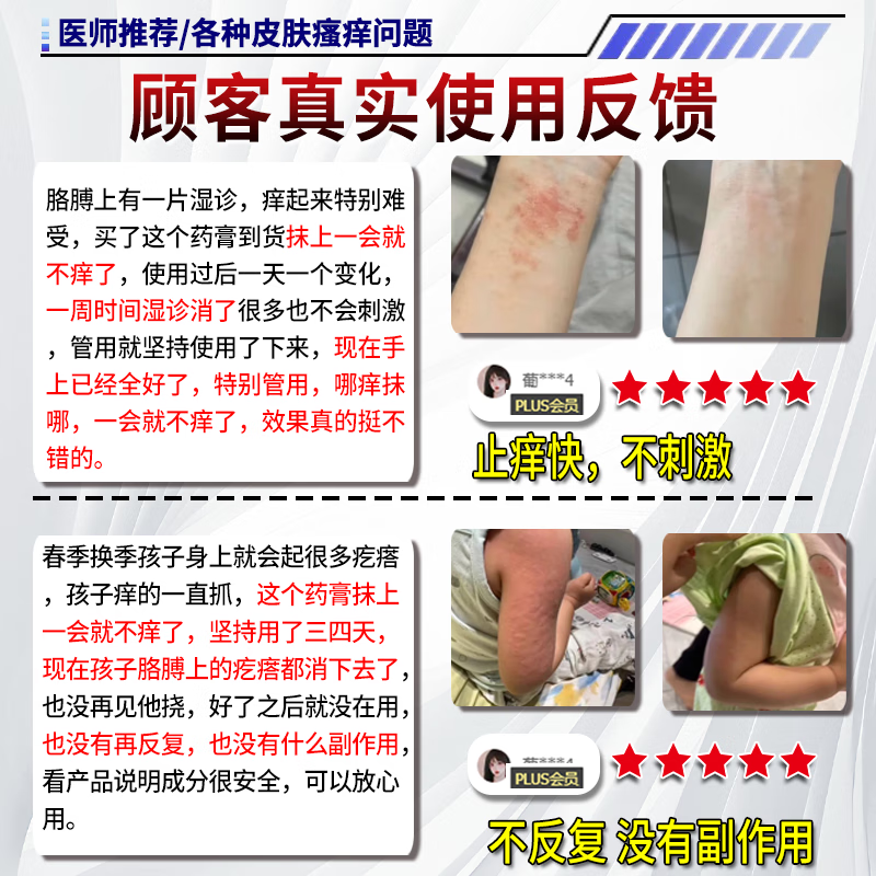狼毒蛇床子祛痒膏止痒膏抑菌皮肤瘙痒皮湿炎疹真菌感染止痒药膏 特效7盒【包治好不再犯】