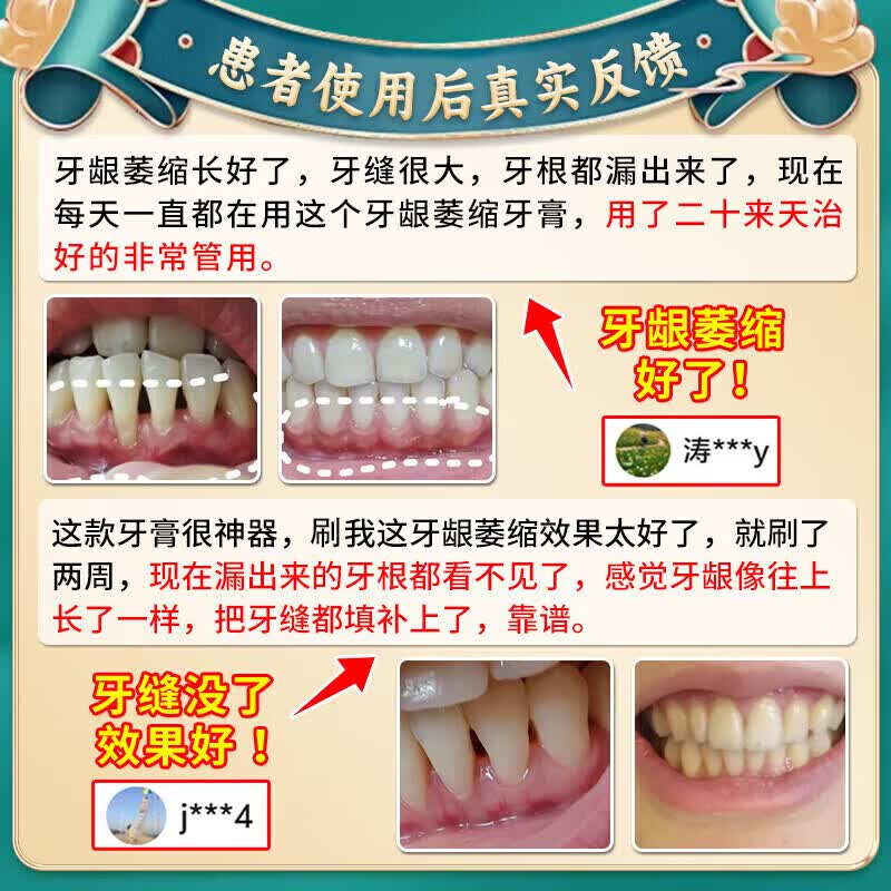 李时珍牙膏护龈固齿牙龈萎缩修复再生牙根外露脱敏膏牙齿松动专用牙周炎 买3送2【100%必裉除】 牙膏修复再生牙根外露金榜第一
