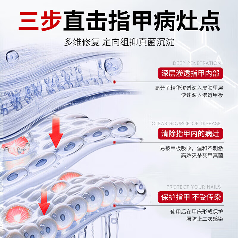 国药药材灰指甲特殊效第1名增厚发黄变空甲中沟草灰甲亮甲凤仙花液 【一个灰甲一盒就行】一盒装 灰指甲100%特效专用的药第一名