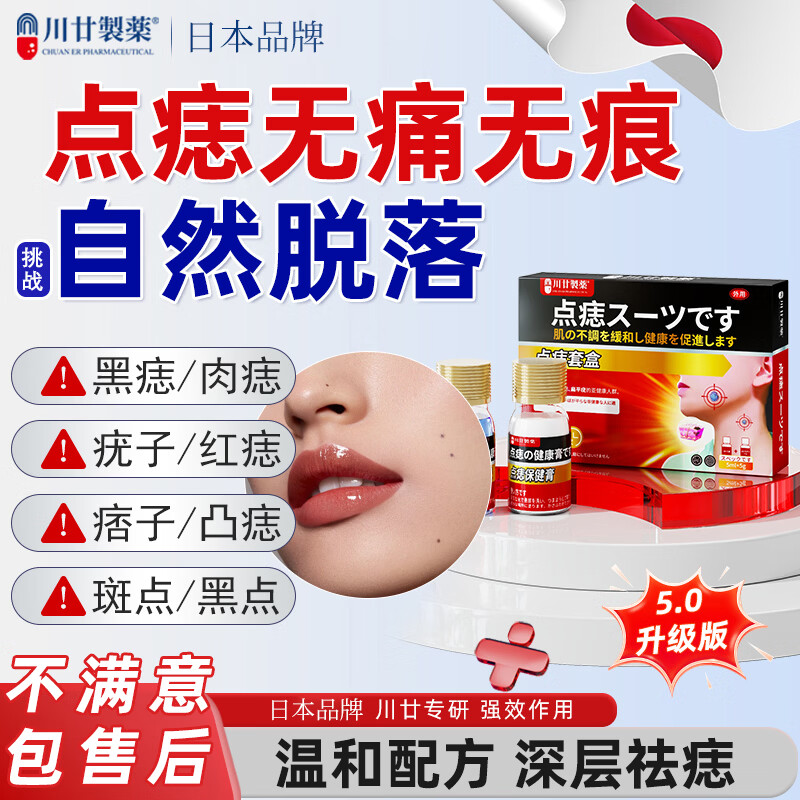 川廿制药点痣膏脸部祛痣专用药水医用点疣斑不留疤无痕去黑痣肉痣痦子瘊子