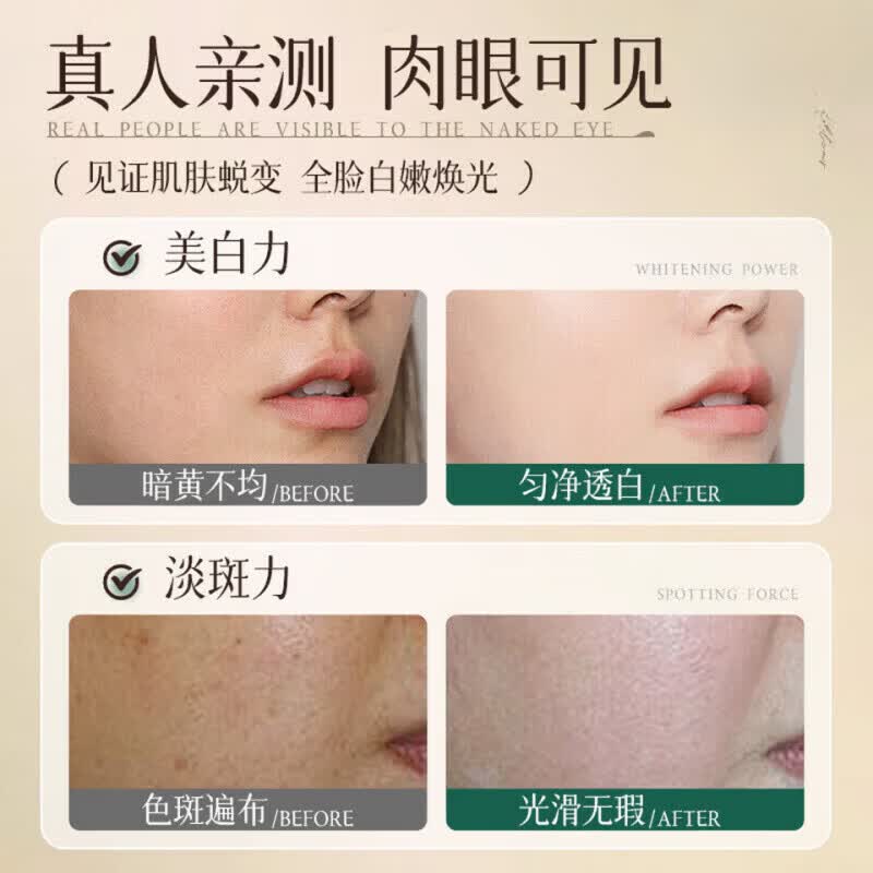 未来氧气面霜酵母菌控油提亮紧致淡纹抗皱保湿控油敏感肌可用 5盒装 买三赠二【囤货装】 【品质保障 谨防低价假货】