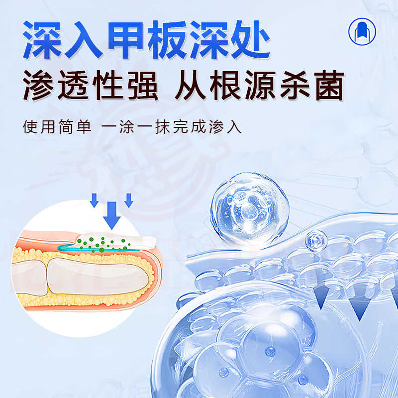 御灵花灰指甲发黄增厚软甲坏甲空甲萎缩甲变色男女适用专用护理膏 1支装【体验发正装】 【官方直售 京质保障】 御灵花灰指甲发黄增厚软甲坏甲空甲萎缩甲变色男女适用专用护理膏 1支装【体验发正装】 【官方直售 京质保障】