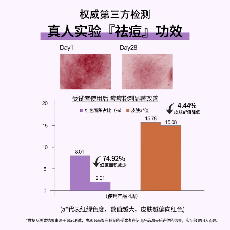 OEM肤润康10壬二酸20乳膏澳洲祛痘凝胶控油修护黑头闭口收缩毛孔 3支装【周期调理装】买二赠一 【官方直售】