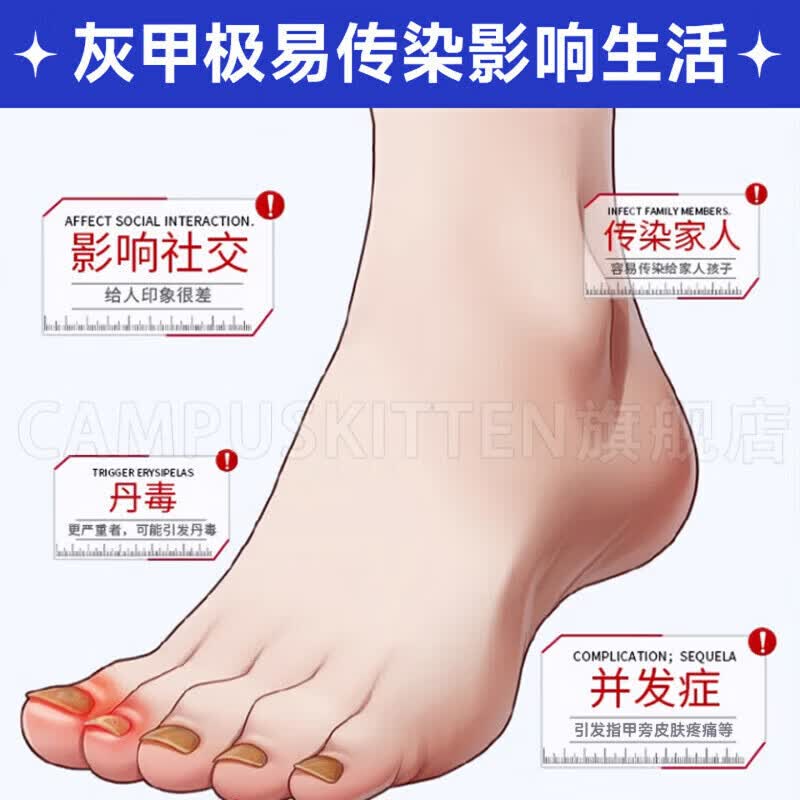 BEIYVS甲贝诺灰甲灰甲保健擦剂专用浑浊坏甲厚变黄真菌感染脱甲官方 1盒【体验见效装】 【官方直售】