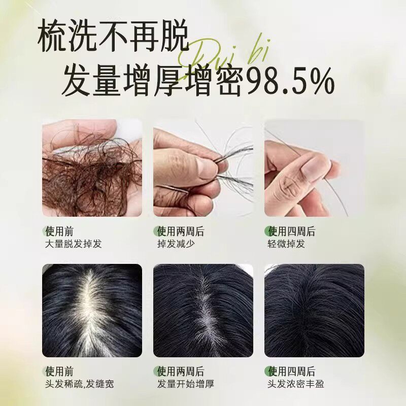 NETST木诺康侧柏叶洗发水草本防脱固发育发密发增发防断发去屑控油止痒 一瓶装【体验装】 【官方旗舰正品 京质保障】