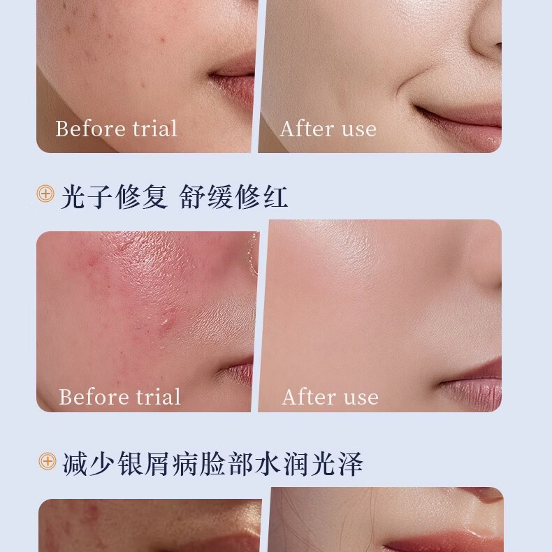绽妍安亦佳海藻酸钠修护敷料术后缓解院线同款保证正品 80g保证正品 去盒刮码发货