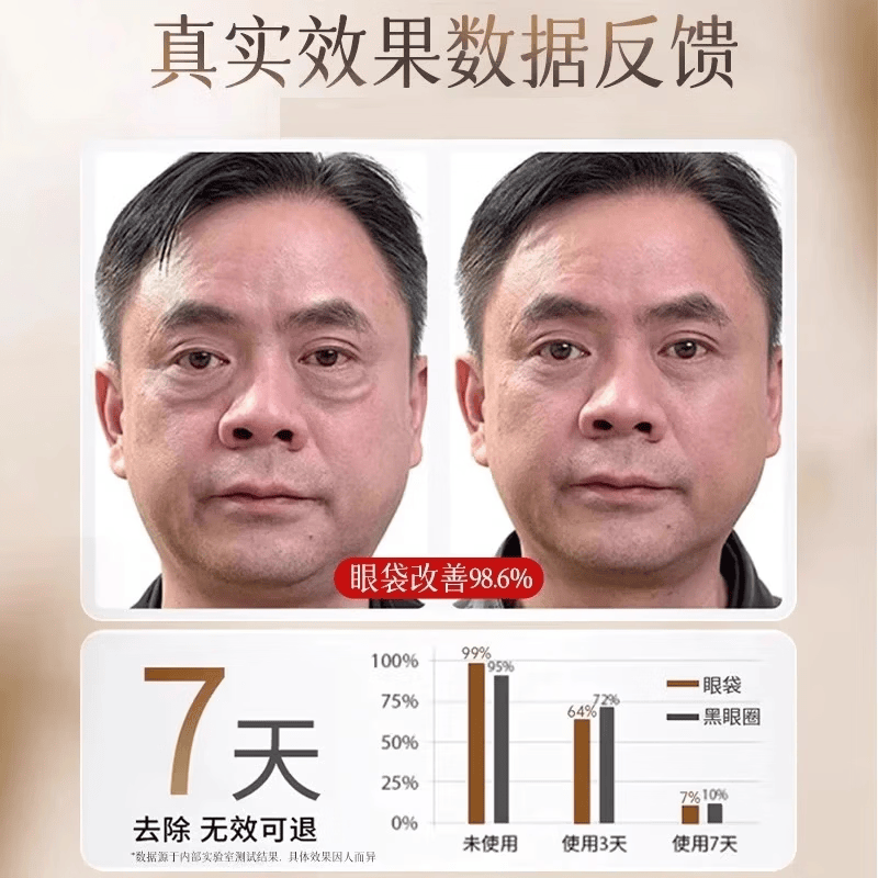 眼袋去除神器男士专用眼霜去重度消除大眼袋严重中老年淡化黑眼圈 特效： 3送2【眼袋不再有】