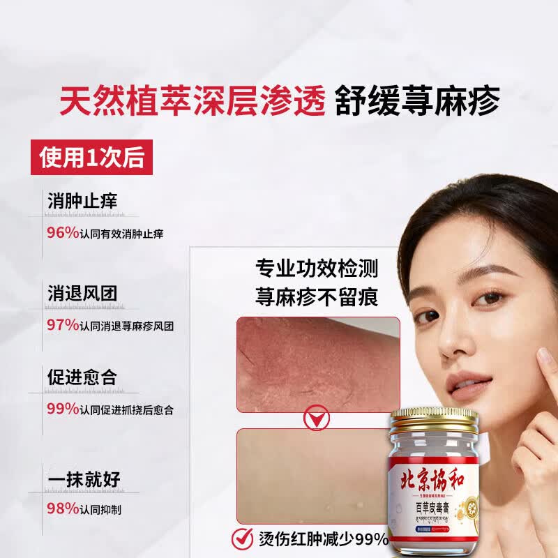 北京协和医学院荨麻疹进口药过敏止痒断i根增强免疫力荨麻疹药膏专用治疗急慢性 1盒装【北京协和】 过敏止痒软膏丘疹性荨麻疹专用