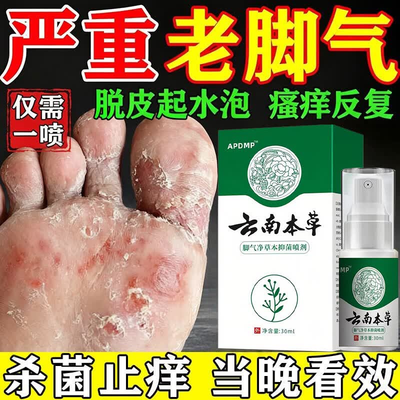 云南本草脚气喷雾脚气止痒脱皮烂脚丫真菌感染根脚痒脚气克星喷剂脚气药治 3瓶周期装【止痒杀菌】云南本草脚气喷剂 去脚臭脚气专用特效脚趾缝烂痒起小水泡痒脱皮膏