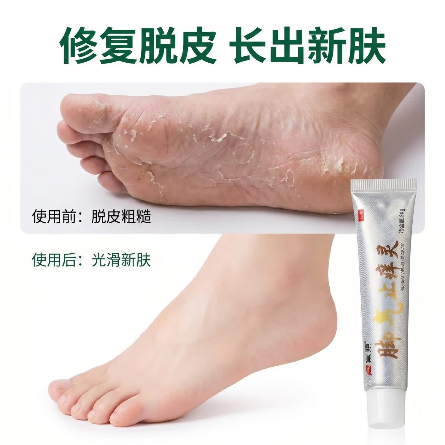 富晴脚气止痒灵脚后跟干裂修复霜防裂足脱皮强效滋润门店同款