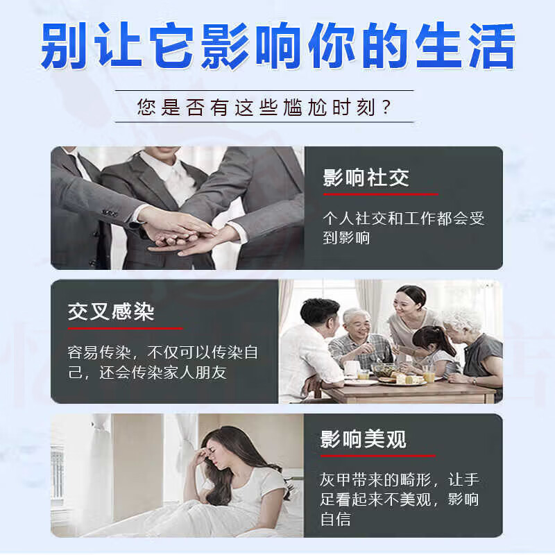 御灵花灰指甲发黄增厚软甲坏甲空甲萎缩甲变色男女适用专用护理膏 1支装【体验发正装】 【官方直售 京质保障】 御灵花灰指甲发黄增厚软甲坏甲空甲萎缩甲变色男女适用专用护理膏 1支装【体验发正装】 【官方直售 京质保障】