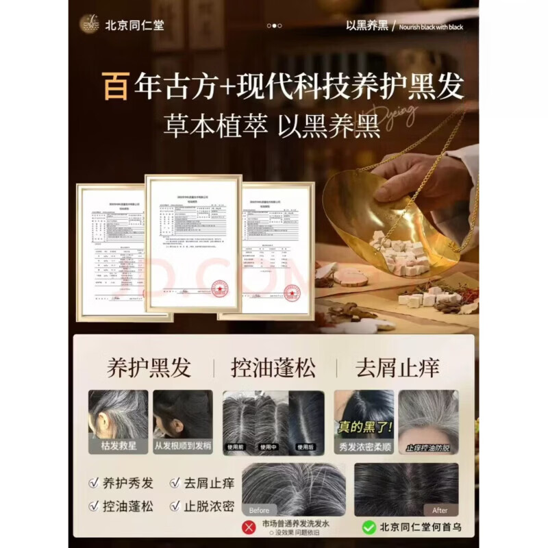 同仁堂（TRT）何首乌生姜洗发水防脱育发固发白发转滋养护黑发根男女通用洗发露 【北京同仁堂】防脱洗发水5瓶装