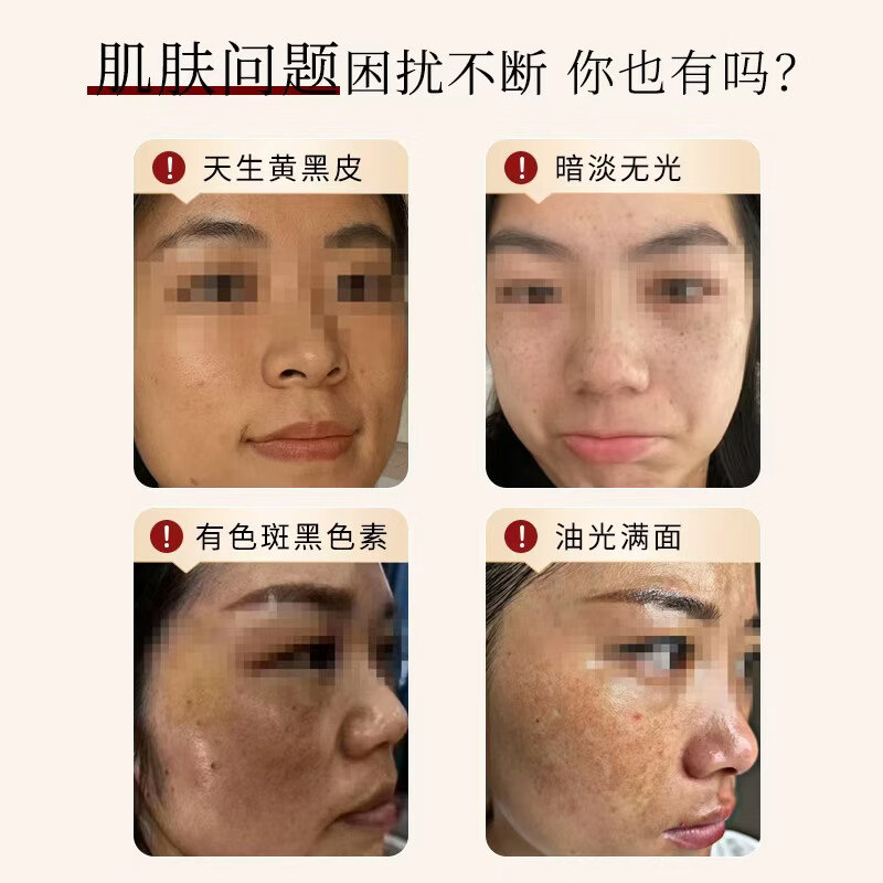 片仔癀烟酰胺美白面霜淡斑去晒斑保湿祛斑霜美白淡化老年黄褐雀斑黑色素 【礼盒4件套】水乳+精华+面霜