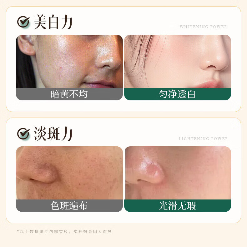 艾雪诗淡斑霜祛斑霜美白祛黄褐斑老年斑去斑雀斑淡化色斑男女通用 5瓶【巩固装】 妤颂个护品牌直售