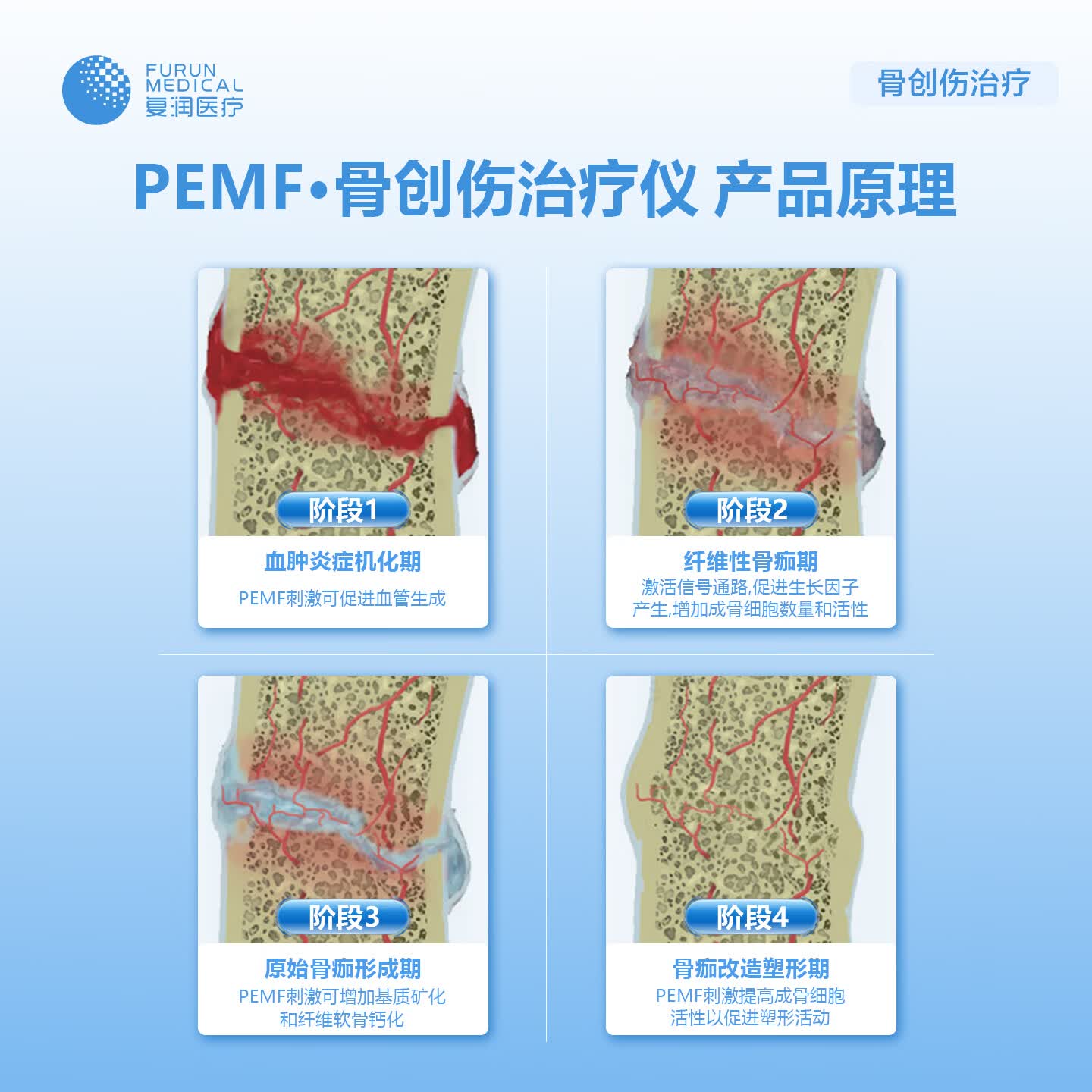复润医疗便携式可穿戴骨创伤治疗仪低频脉冲电磁场(PEMF)一体化理疗仪 骨创伤治疗仪 ES-BA-II治疗仪(腰带款)