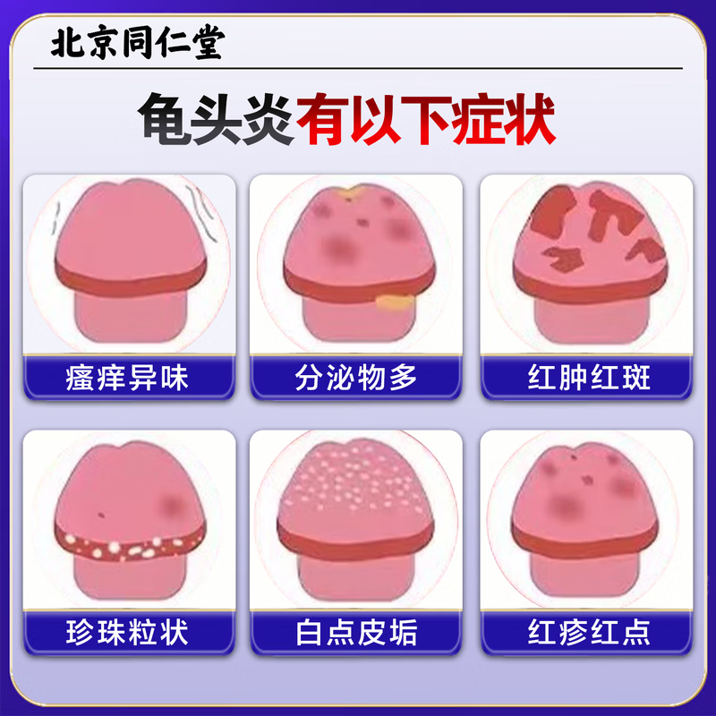 同仁堂(TRT)龟头炎专用膏药龟头真菌感染红肿包皮炎白垢豆腐渣红点瘙痒喷剂 买3送2【100%包全愈】 特效男士私处杀菌消炎止痒喷剂