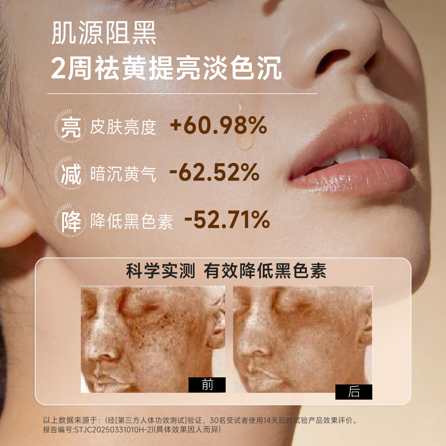 自然攻略6%氨甲环酸高浓度精华液黄褐斑舒缓肌肤毛孔15ml呵护肌肤 15ml 【送女朋友必选】