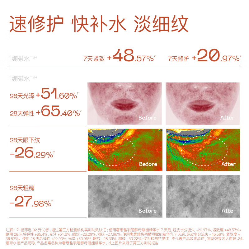 奢思雅酵母绷带水乳干敏保湿修护抗皱精华水干皮救星爆皮爽肤水湿敷水 绷带水+绷带乳