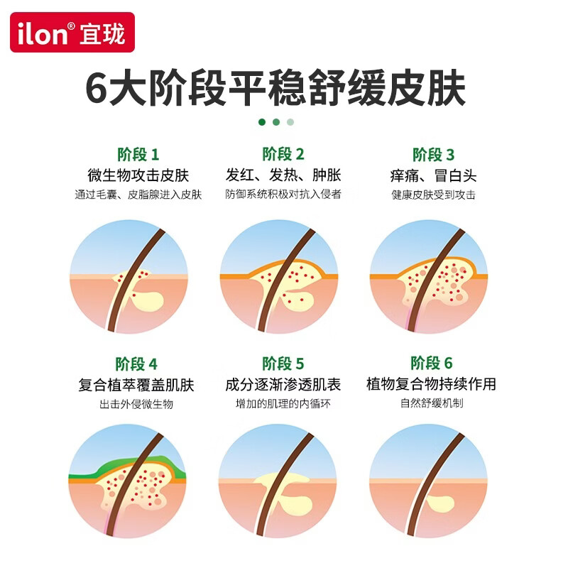 宜珑(ilon)德国Ilon classic经典舒缓软膏退红保湿消火火小绿管50ml ilon舒缓膏