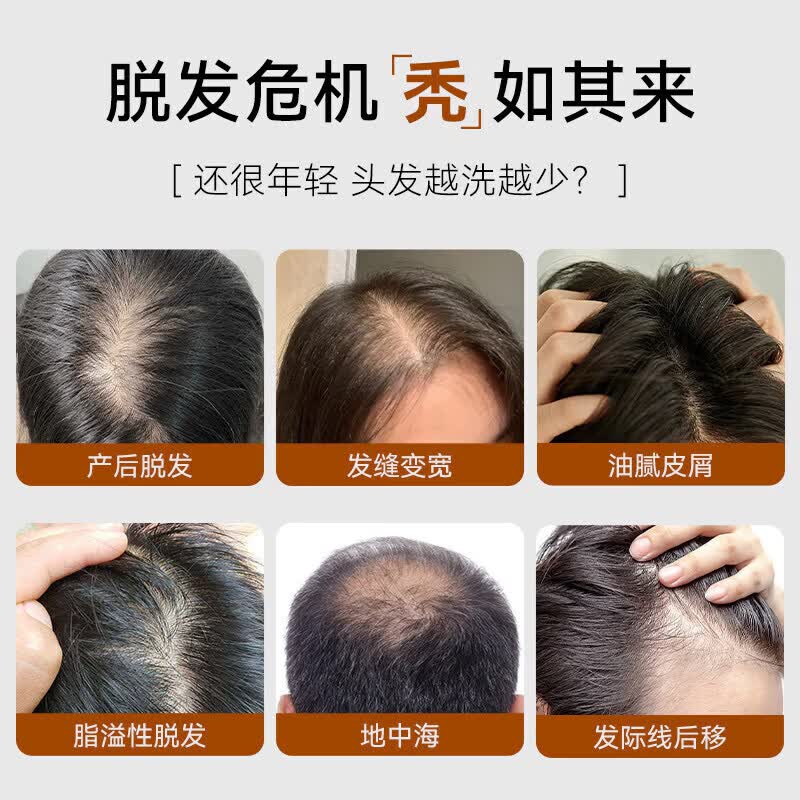 UROSE海文赫黑金罐洗发膏舒缓无硅油控油蓬松柔顺亮泽留香洗发水防脱 两瓶装 改善装 【官方旗舰 京质保障】