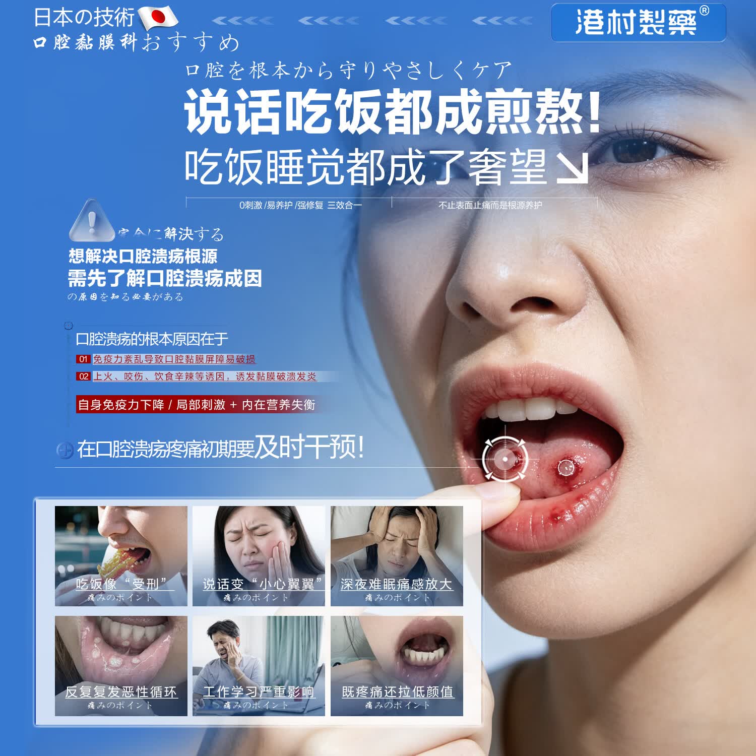 港村制药口腔护理保健液溃疡喷雾剂溃疡喷雾剂凝胶上火起泡口舌 5瓶装 买三赠二【巩固装】 【官方直售 京质保障】