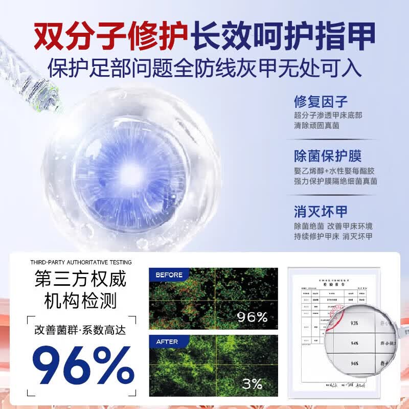 国药药材灰指甲第1名药灰指甲专用指甲真菌感染脱甲坏甲新亮甲根i治抑菌液 1盒装【1-2个推荐】 灰指甲100%特效专用的药第一名
