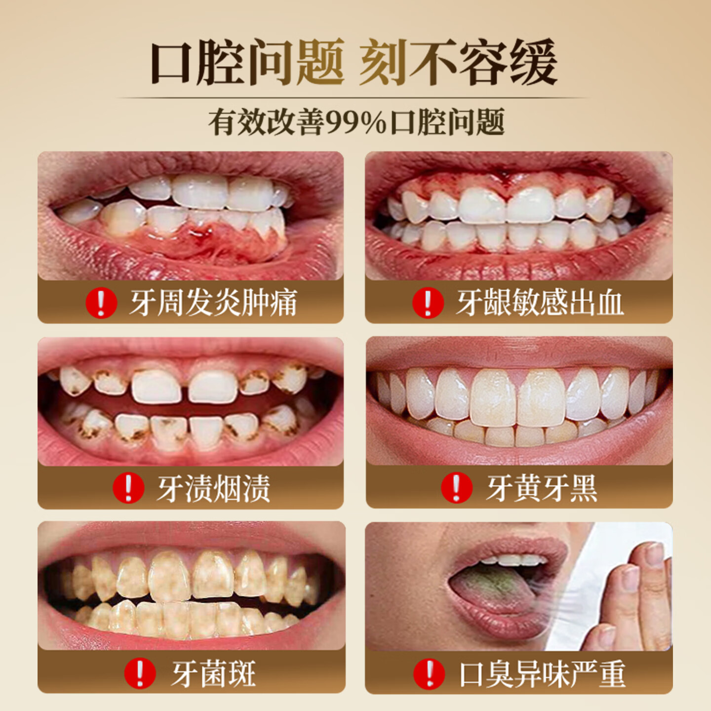 京都同仁美白牙膏3X牛黄口腔膏去烟渍去黄去口臭护龈固齿牙龈修复脱敏膏 清焱 【牙龈红肿出血/牙炎可用】护龈金标版120g
