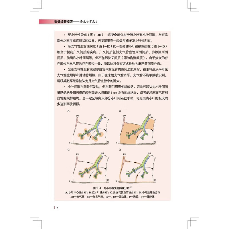 影像诊断技巧 要点与盲点 2 影像诊断 读片技巧 影像解剖 专家教你快速掌握影像读片技巧 北京科学技术