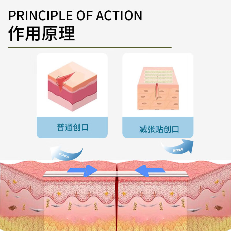 暨可复医用无敏透气胶带减张创面敷料免缝胶带胶布儿童孕妇通用术后祛疤 【单盒装】专利认证