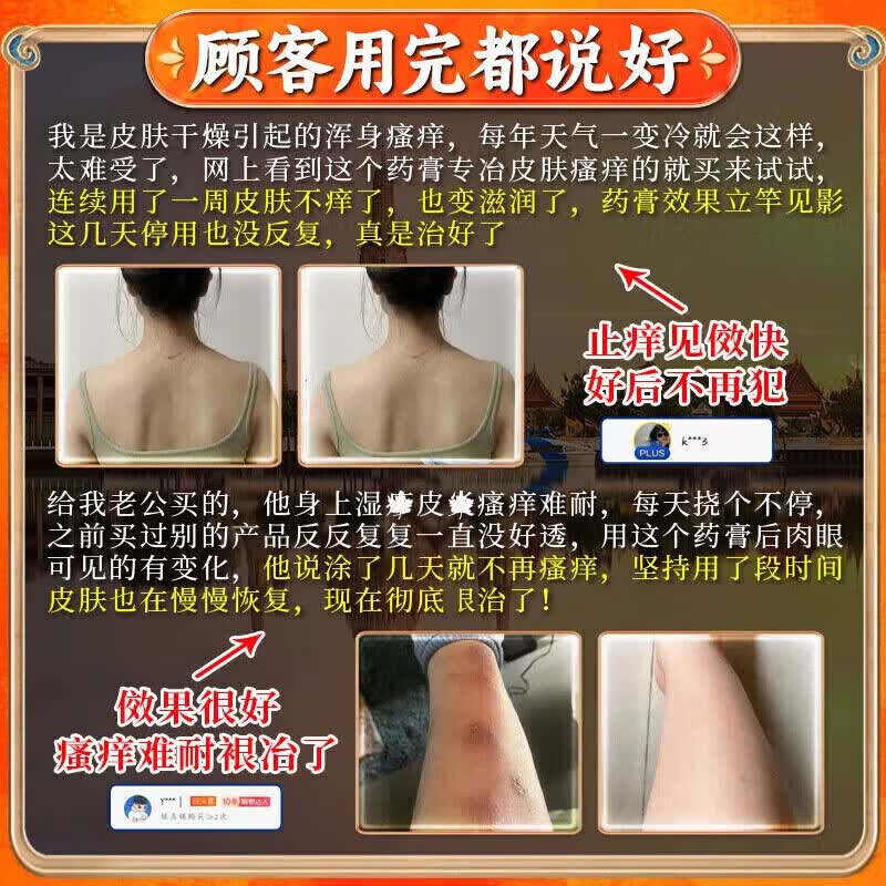 云南本草皮肤瘙痒止痒杀菌100%特傚膏皮焱湿诊真菌皮肤干燥瘙痒止痒断痒王 50g*1盒特效膏 .