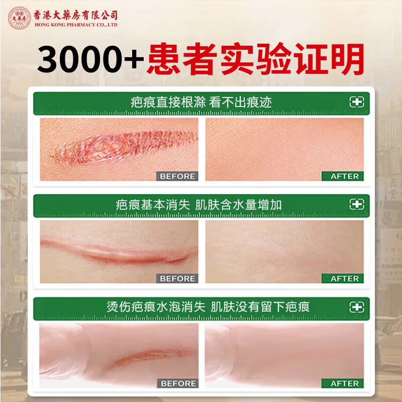 香港大药房有限公司贴膏草本萃取护理膏疤痕旧疤伤疤淡印凹凸增生痘坑软膏痘印痘坑 1瓶 【买2送1】推荐周期装