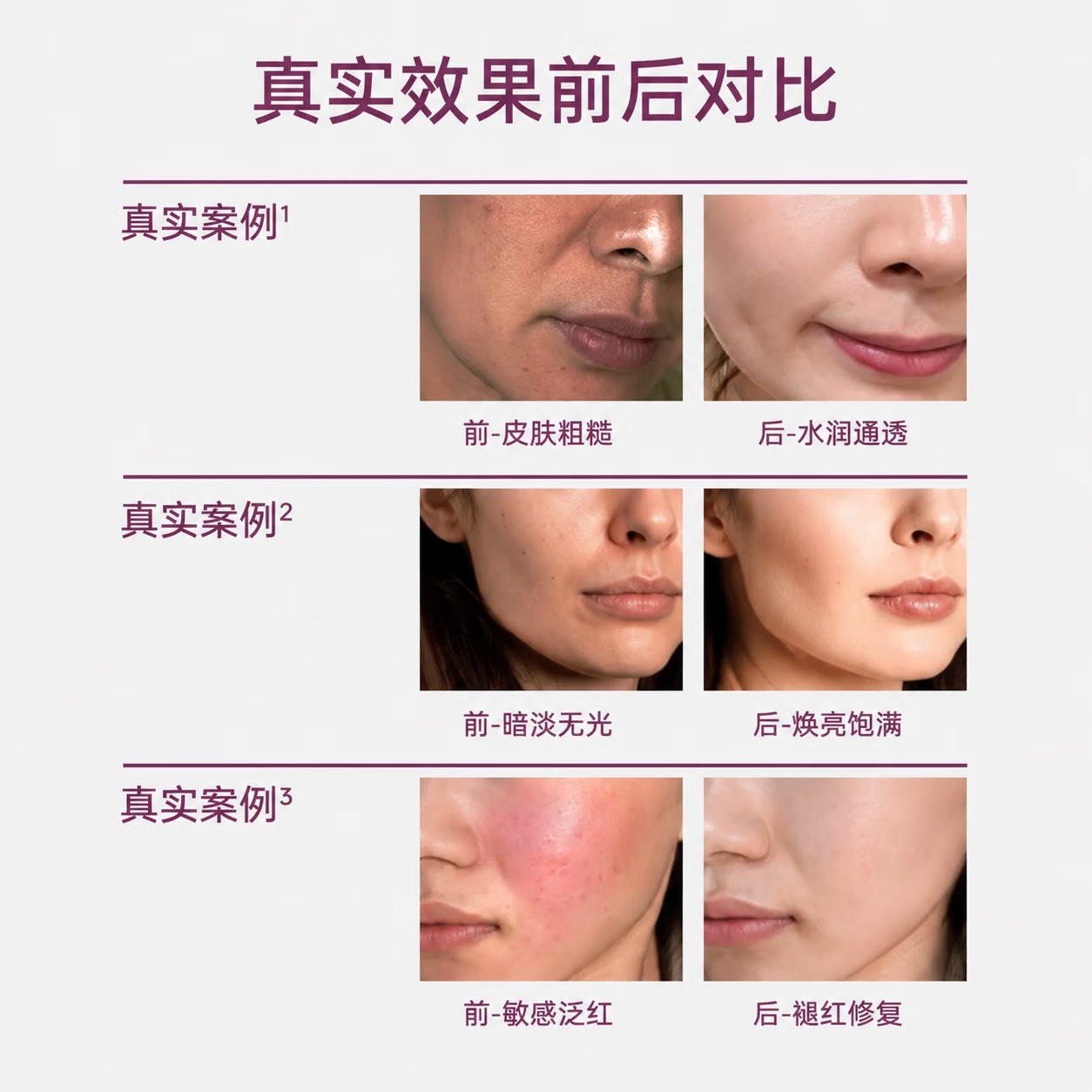 VIABLIFE NEW GENERATION面膜补水保湿去黄气提亮肤色烟酰胺补水面膜敏肌女朋友520礼物 1盒装(买1盒送1片,共6片) VIABLIFE NEW GENERATION面膜补水保湿去黄气提亮肤色烟酰胺补水面膜敏肌女朋友520礼物 1盒装(买1盒送1片,共6片)