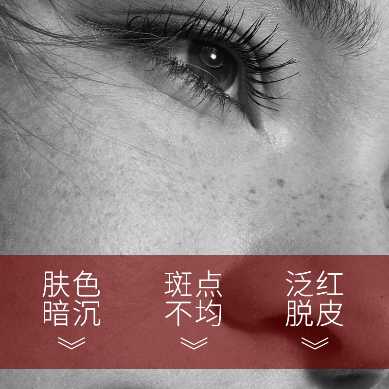 片仔癀烟酰胺美白面霜淡斑去晒斑保湿祛斑霜美白淡化老年黄褐雀斑黑色素 【礼盒4件套】水乳+精华+面霜