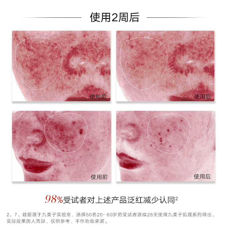 九美子虫草舒缓精华乳100ml舒缓补水保湿清爽滋润提亮护肤正品 100ml