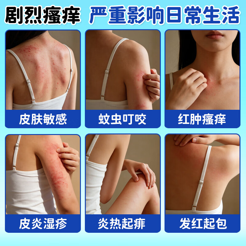 RAKOOL日本进口东光蚊虫叮咬皮肤过敏湿疹痱子荨麻疹止痒消肿成人儿童夏季皮肤不适家用温和舒缓外用乳液50ml Rakupion乳液50ml*3瓶