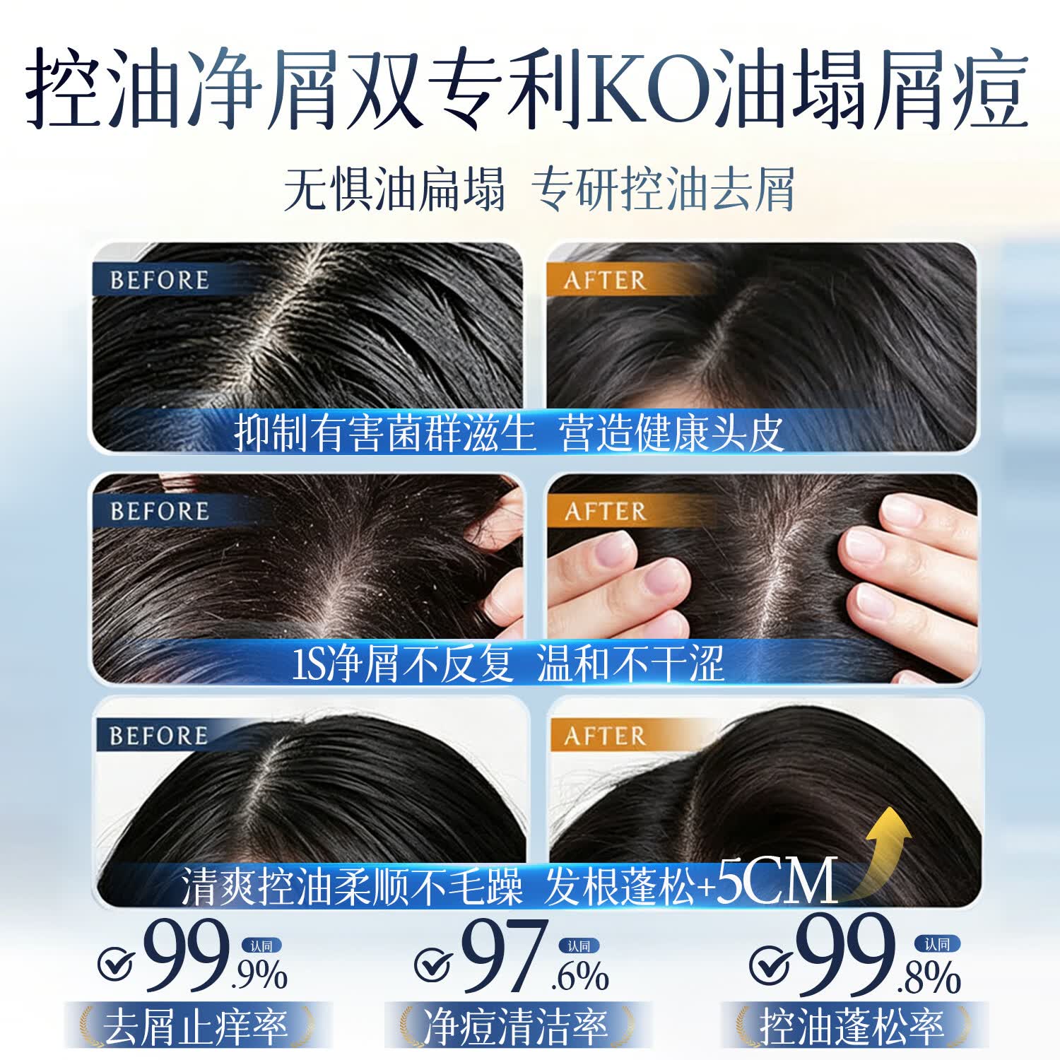 范泳辰（fanyongchen）洗发水去屑止痒控油持久蓬松留香氨基酸洗头膏男女士专用洗发露 【控油蓬松】雪松清茶洗发水800ml 控油蓬松洗发水热卖榜第1名
