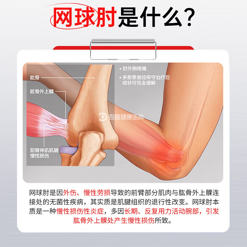 坂崎制药护肘网球肘专用膏贴手腕拉伤腱鞘炎膏贴手肘劳损疼痛关节酸胀无力 周期装【买二送一 共三盒】
